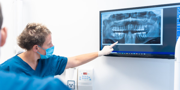 implant dentaire